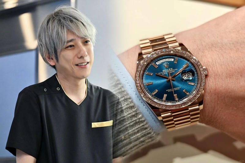 オメガとロレックスはどちらが高いですか？