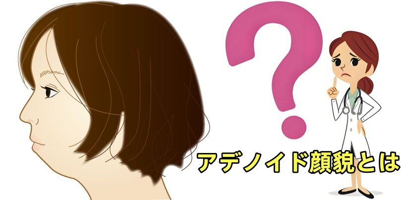 1. アデノイド顔貌とは？.jpg