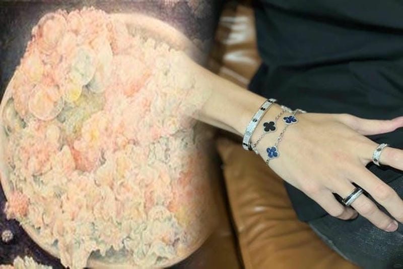 ヴァンクリーフピアスの痛みを解消する方法