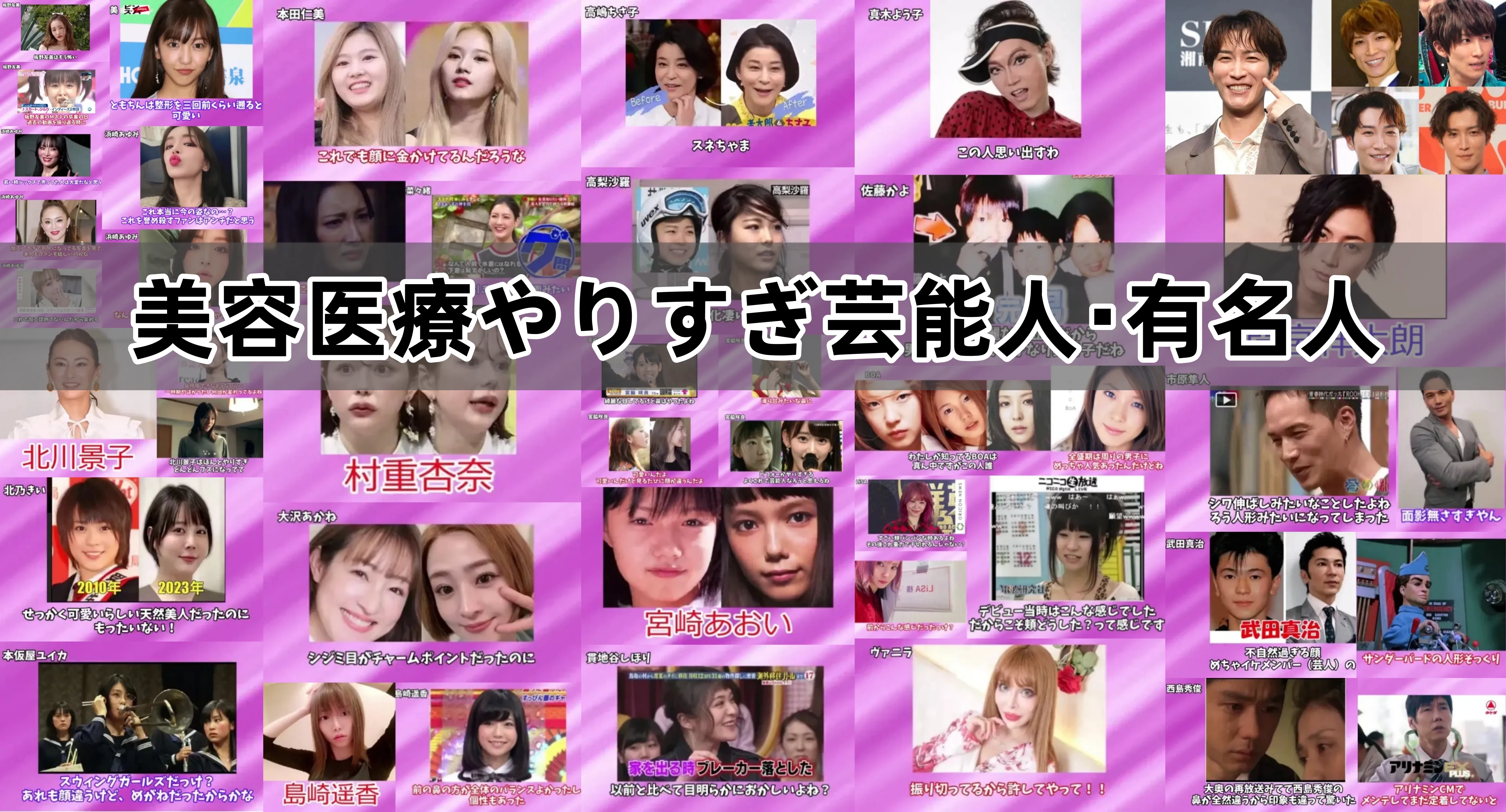 美容医療やりすぎ芸能人・有名人.webp