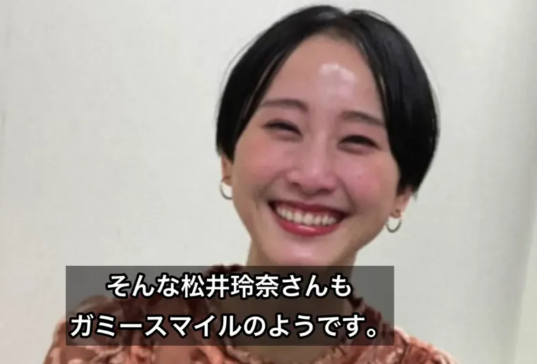 松井玲奈 ガミースマイル