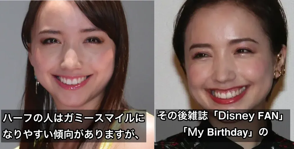 豊田エリー ガミースマイル