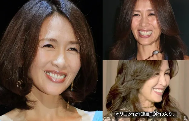 工藤静香 ガミースマイル