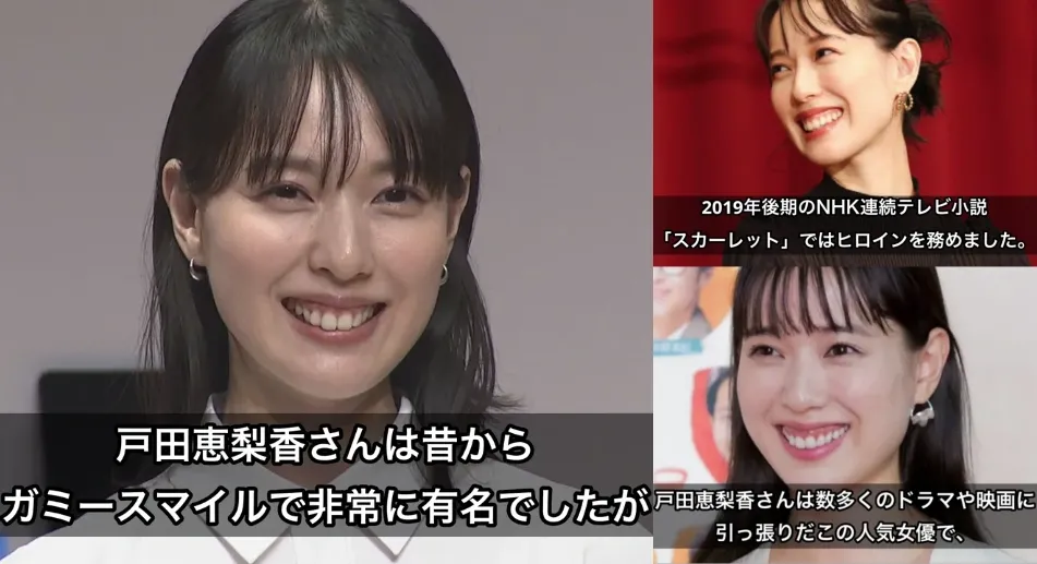 戸田恵梨香 ガミースマイル