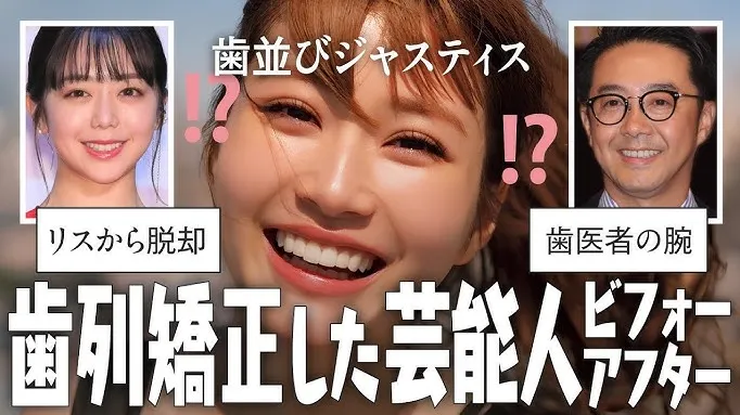 7. まとめ｜ガミー スマイル 芸能人から学べること.webp